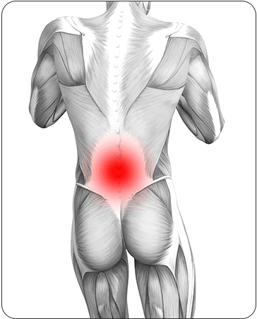 Lower Back Muscle Strain 