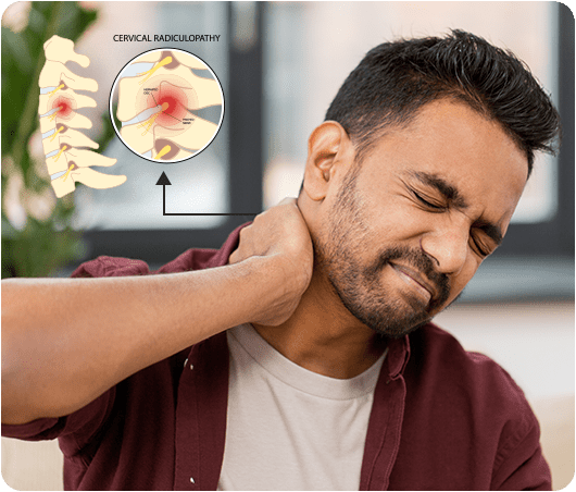 Cervical Spinal Canal Stenosis Treatment, Symptoms & Causes