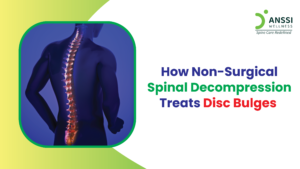 Non-surgical spinal decompression is a treatment designed to relieve pressure on spinal discs using a specialised, motorised decompression table.