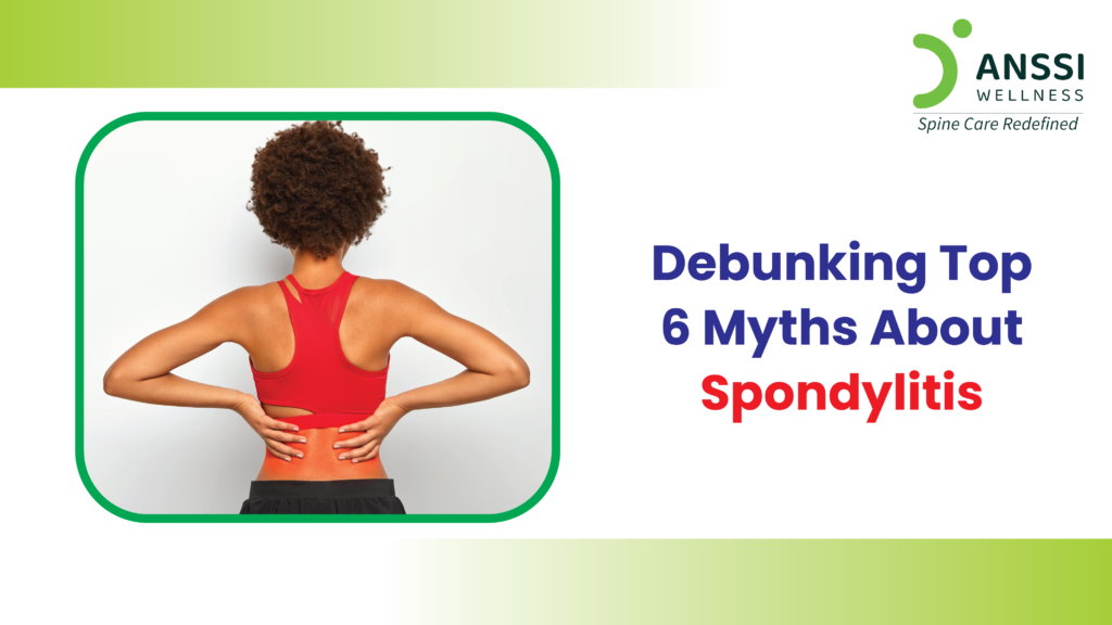 Spondylitis is a chronic inflammatory condition affecting the spine and joints