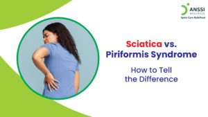 Sciatica and piriformis syndrome share similar symptoms but have different causes and treatments.