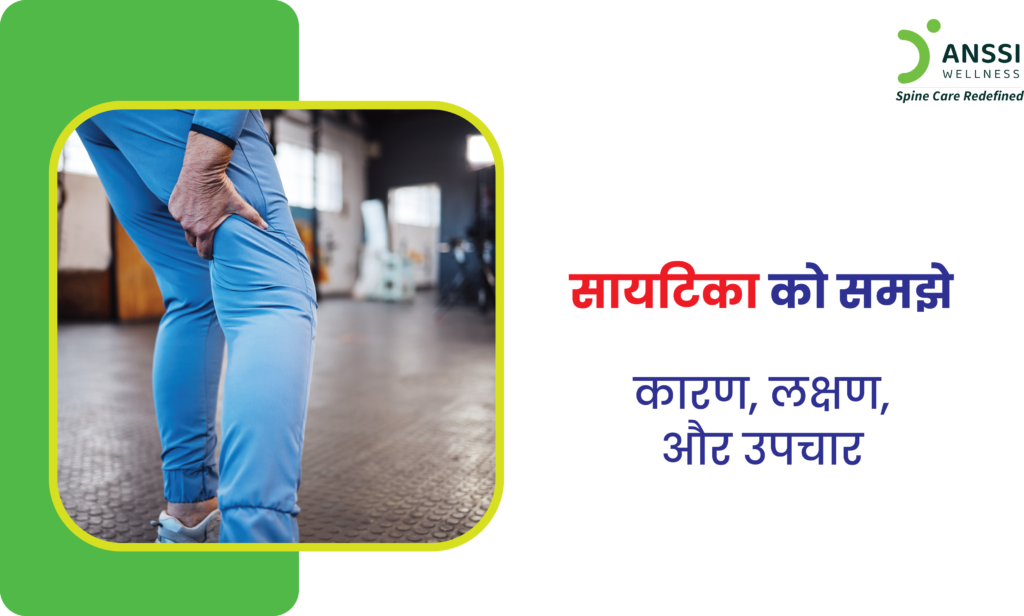 सायटिका (Sciatica) एक ऐसी स्थिति है जिसमें शरीर की सबसे लंबी नस, सायटिक नर्व, में जलन या दबाव के कारण दर्द होता है।